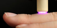 Plasmaquelle am Finger