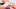 Bild Plasmaderm